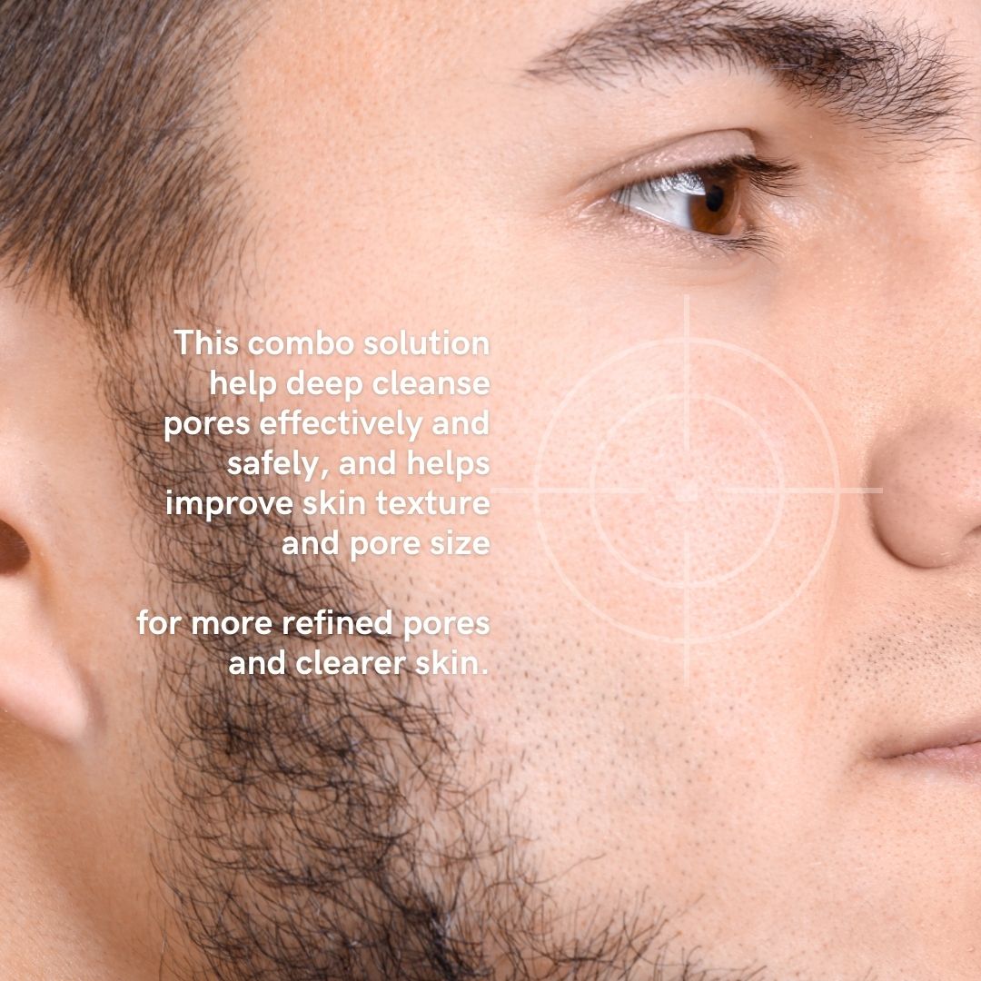 Noah Pore Less Pack (For Tighter Pores, Clearer Skin, and Fresher Face)
