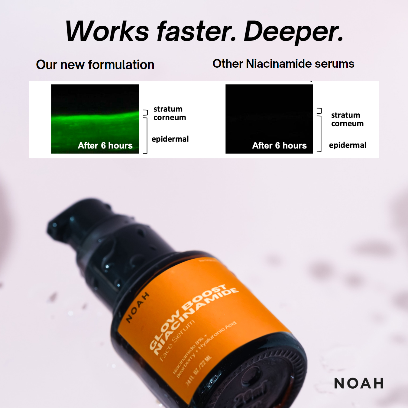 Noah Glow Boost Niacinamide Face Serum 22mL with Formula Booster (Works faster to control oil, acne, increase radiance and improve pore size)